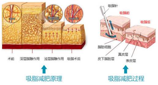 威尼斯注册送66